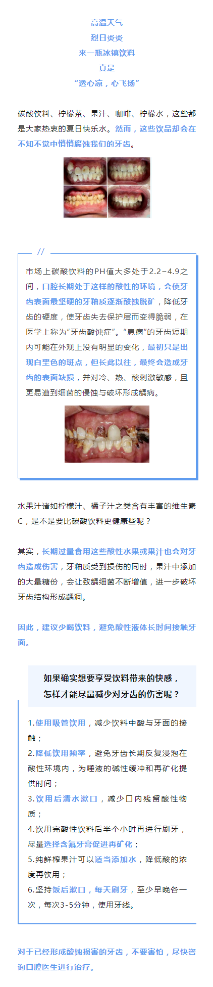 医学科普｜太多“夏日快乐水”，会让牙齿不快乐.png