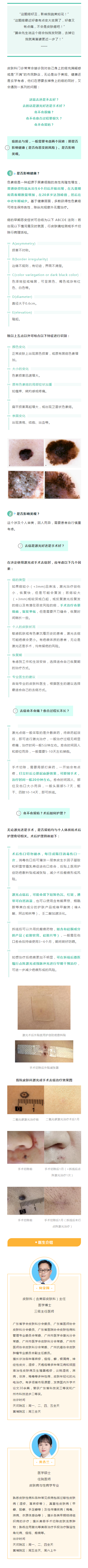 医学科普｜去痣后会不会留疤？激光与手术的抉择，一文读懂——.png