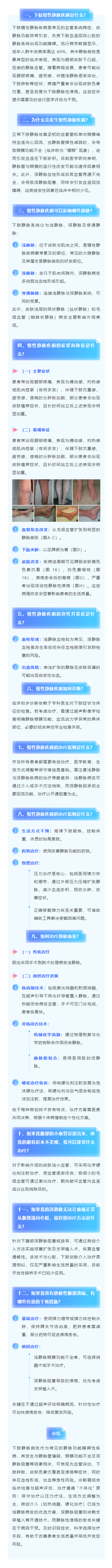 下肢静脉曲张患者健康指南：从病因到治疗.png